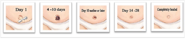 umbilical-cord-complete